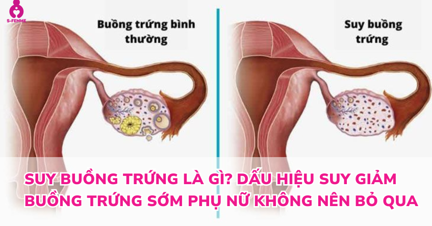 Suy buồng trứng là gì? Dấu hiệu suy giảm buồng trứng sớm phụ nữ không nên bỏ qua