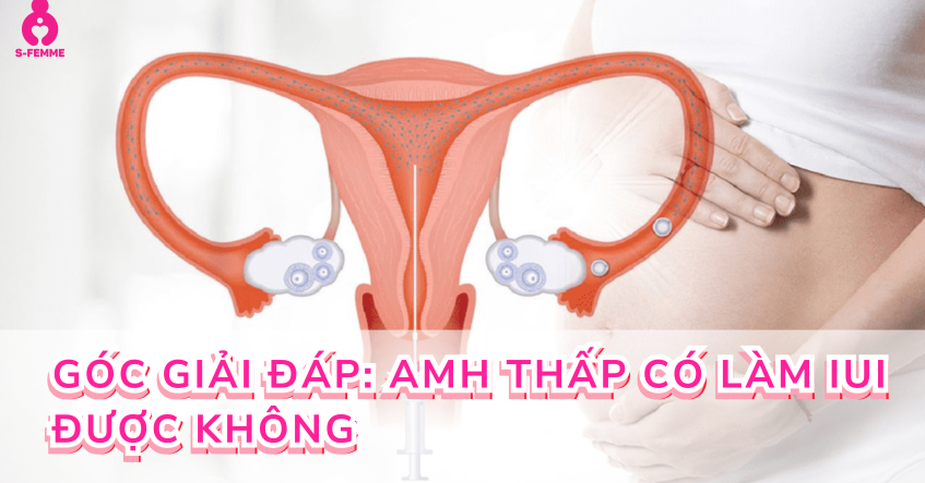 Góc giải đáp: AMH thấp có làm IUI được không​