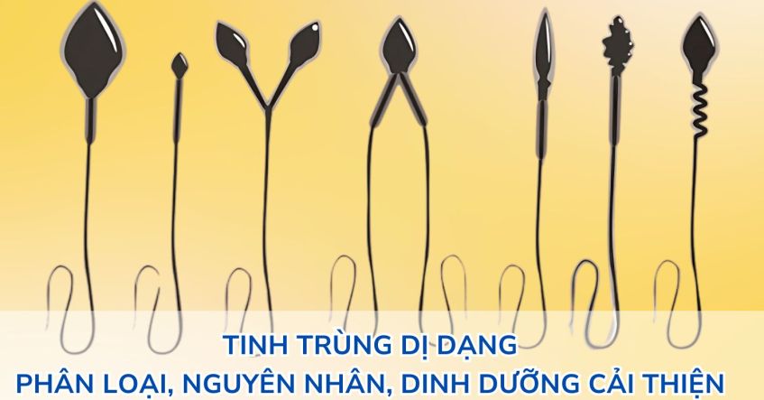 Tinh trùng dị dạng là gì? Phân loại, Nguyên Nhân, Dinh dưỡng cải thiện