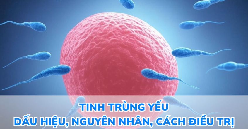 Tinh trùng yếu là gì? Dấu hiệu, Nguyên nhân, Cách điều trị