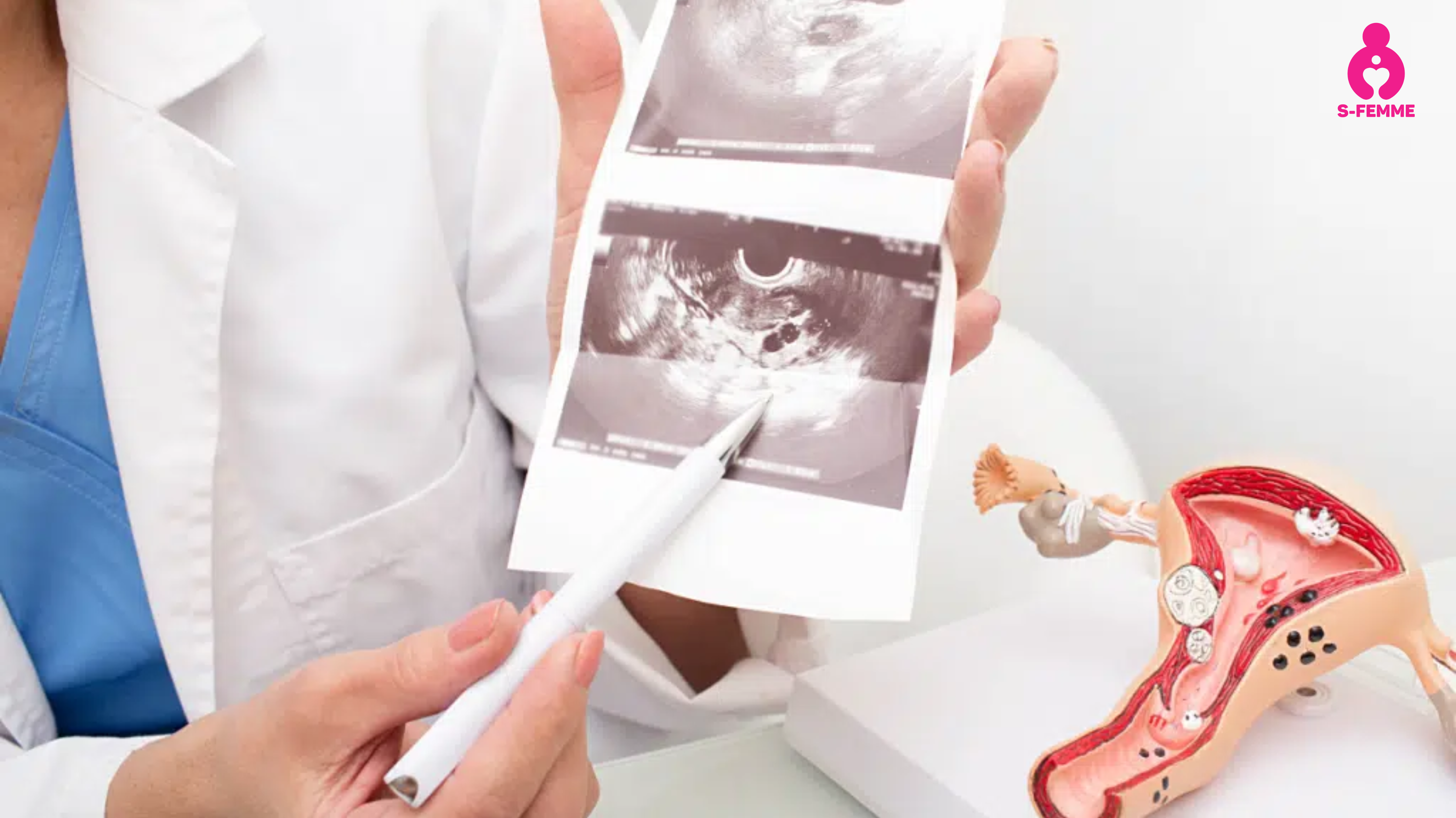 Bị tắc 1 bên vòi trứng có làm iui được không