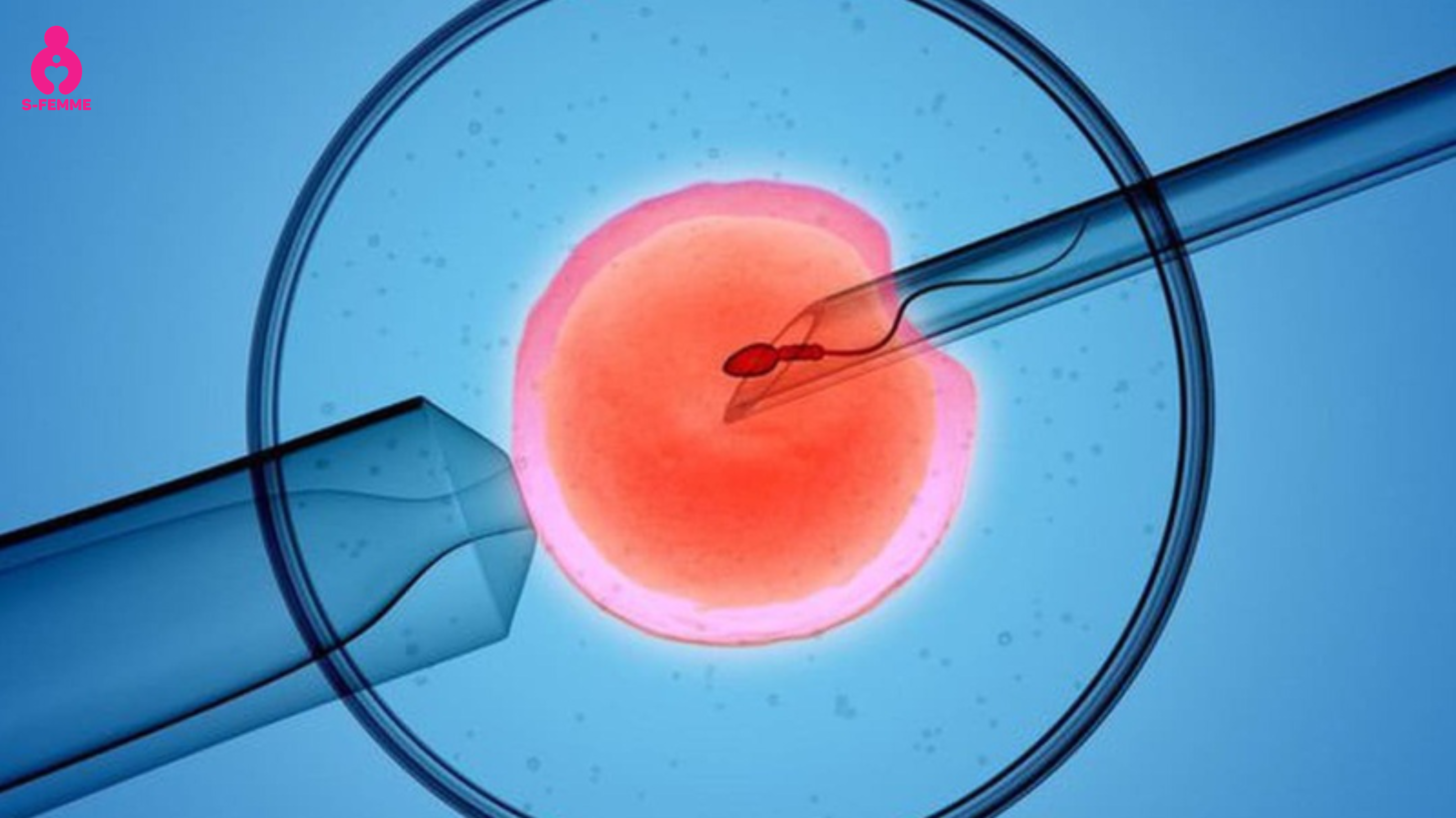 IVF  là gì
