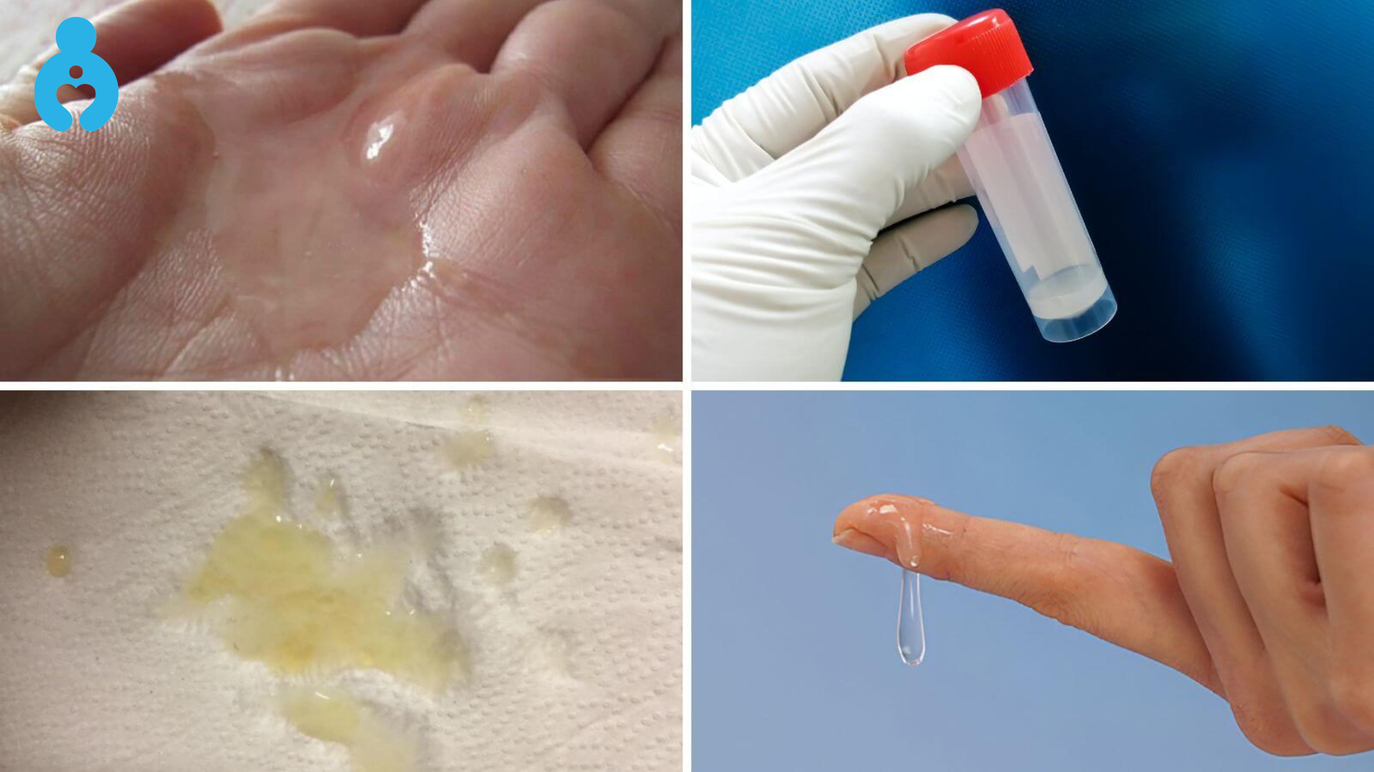 Dấu hiệu nhận biết tinh trùng ít và loãng