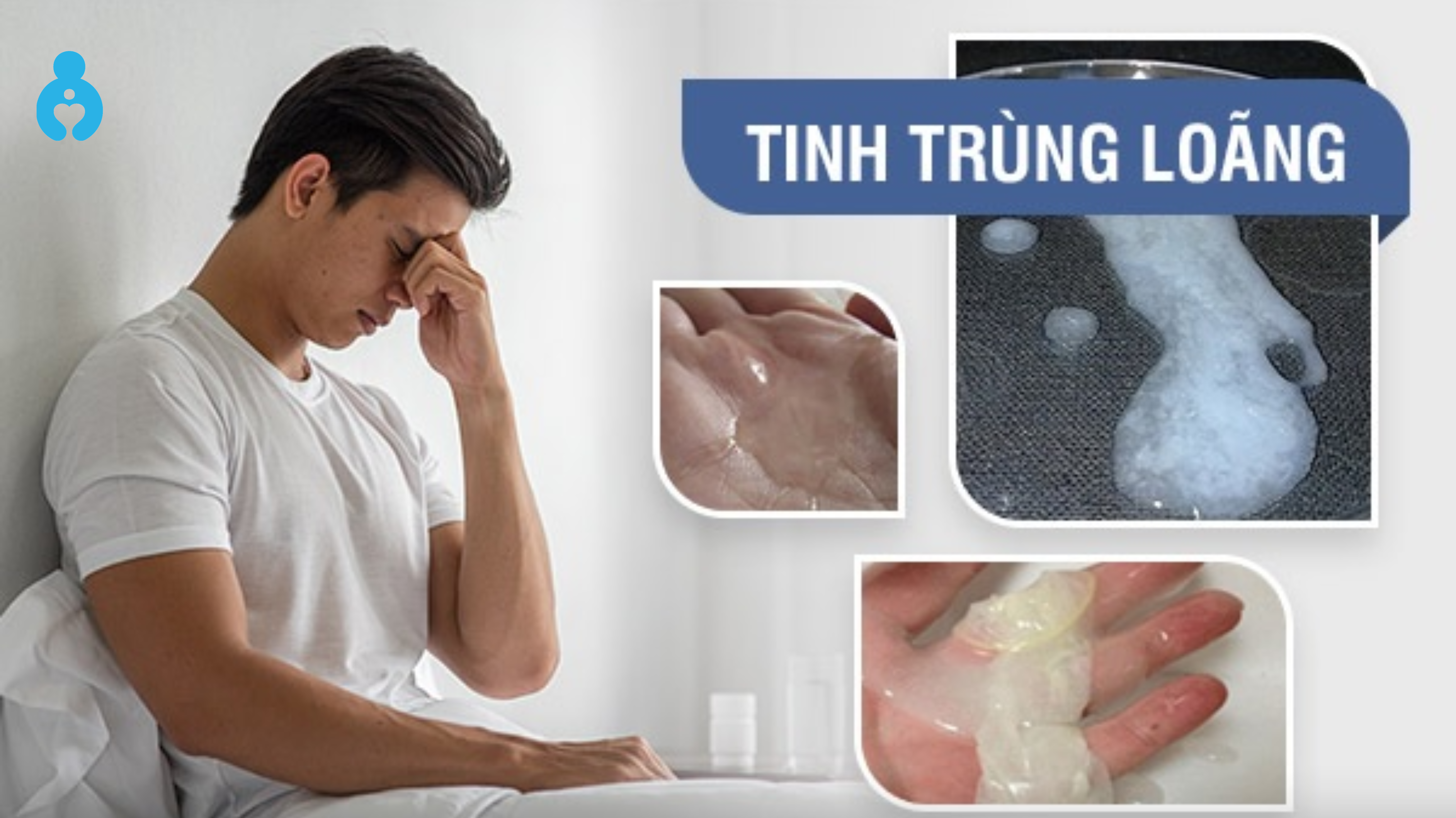 Nguyên nhân khiến tinh trùng loãng bất thường