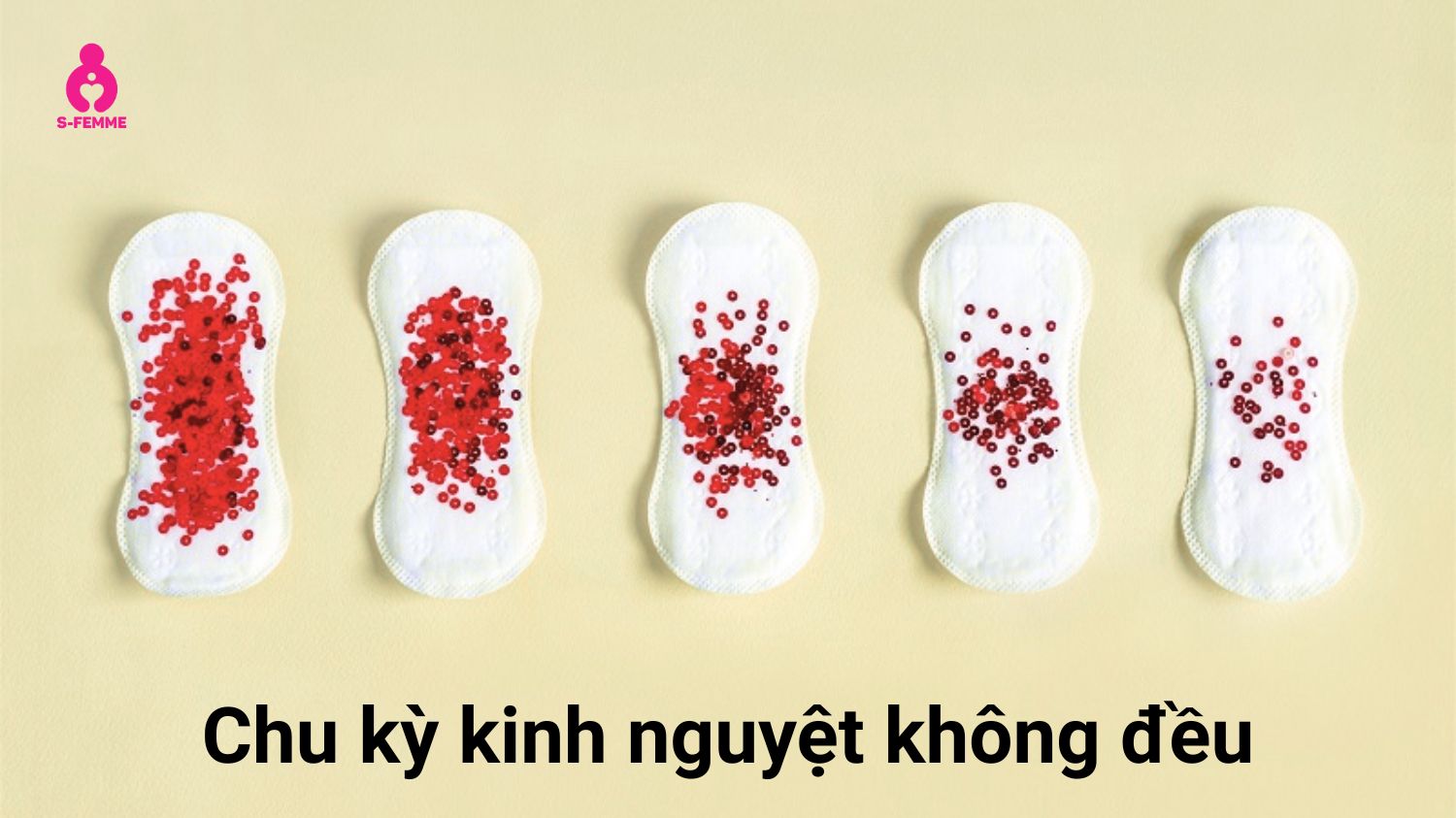 Kinh nguyệt không đều là dấu hiệu của buồng trứng phát triển kém