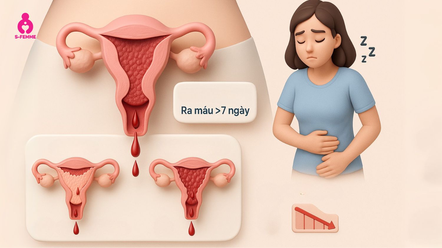 Dấu hiệu rối loạn kinh nguyệt tuổi dậy thì là rong kinh
