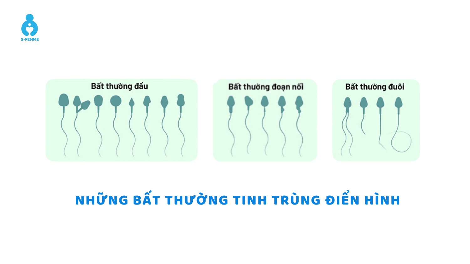 nhung-bat-thuong-tinh-trung-dien-hinh-o-nam-gioi-s-men