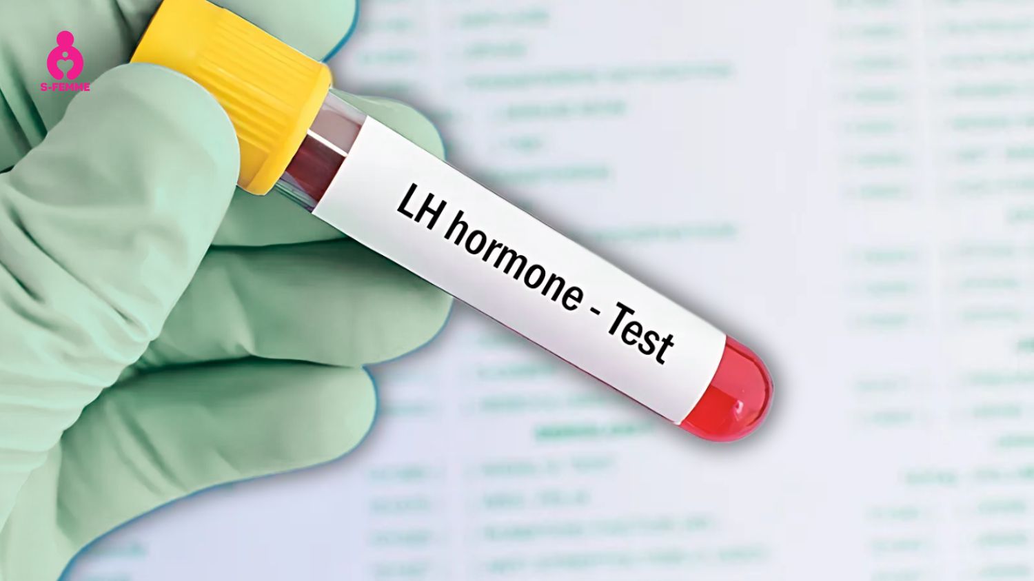 Phụ nữ mắc buồng trứng đa nang thường có nồng độ Hormone LH cao bất thường