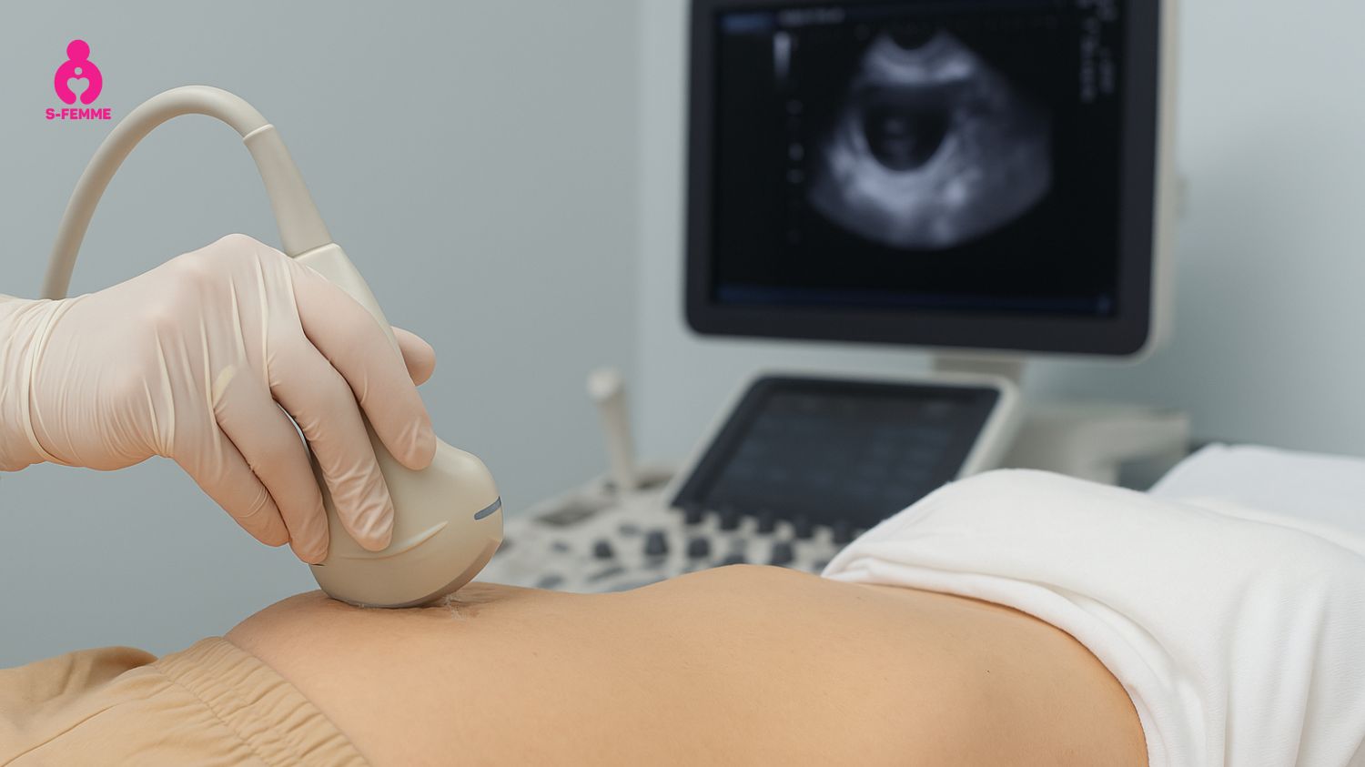 Siêu âm buồng trứng là một trong các phương pháp chẩn đoán buồng trứng đa nang hiệu quả