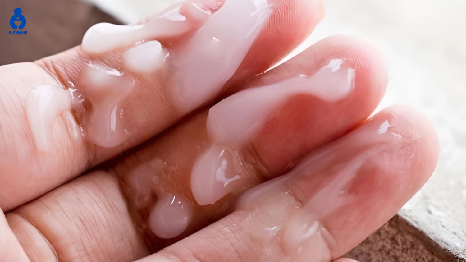 Tinh trùng vón cục là một trong những cảnh báo dấu hiệu tinh trùng yếu